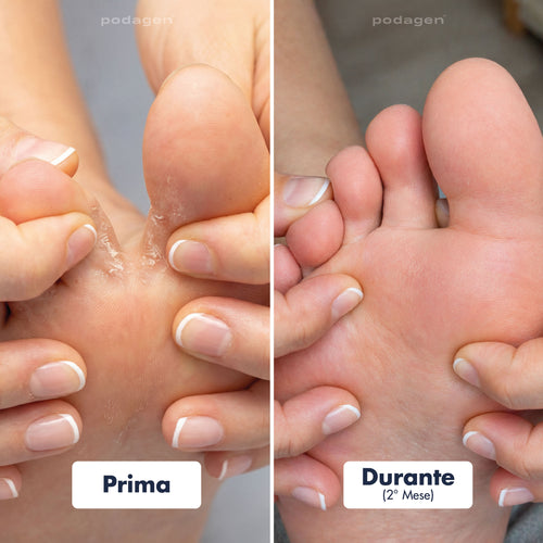 Penna Trattamento Piedi Donna