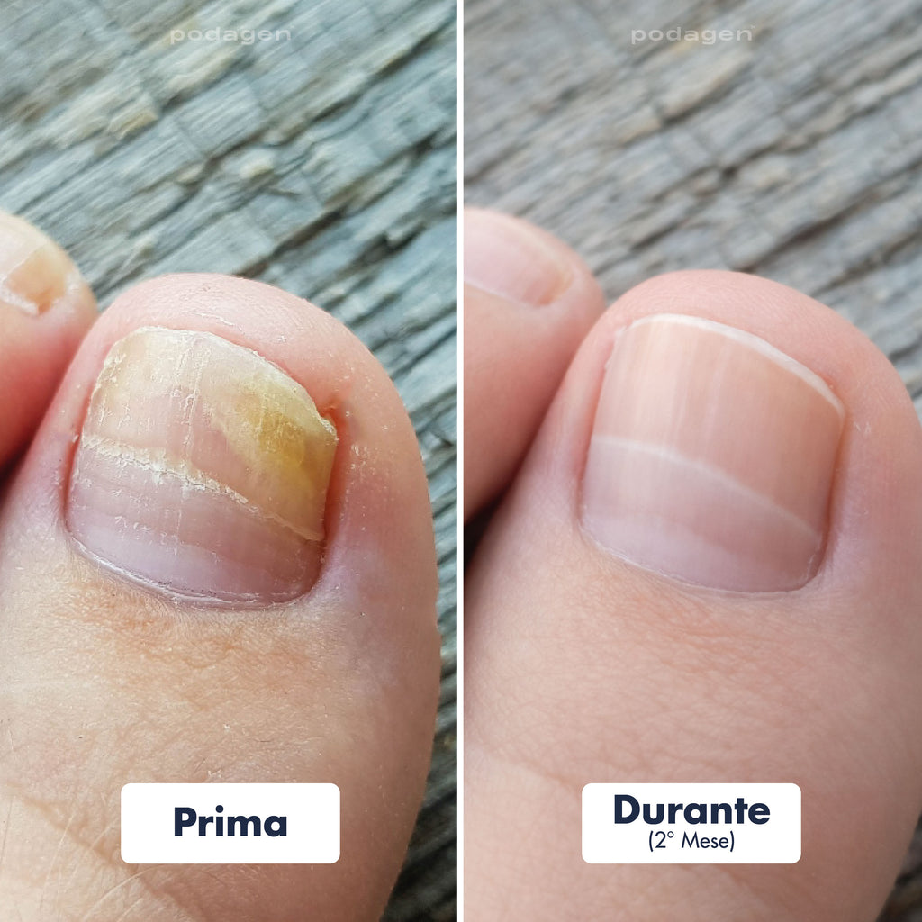 Penna Trattamento Piedi Donna