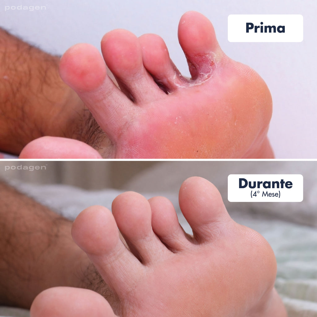 Penna Trattamento Piedi Uomo