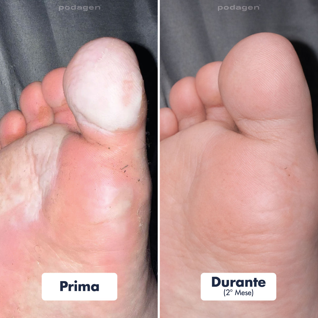 Penna Trattamento Piedi Uomo