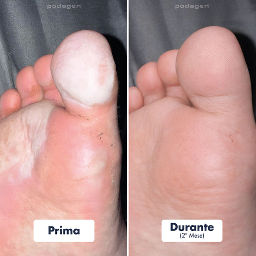 Penna Trattamento Piedi Uomo