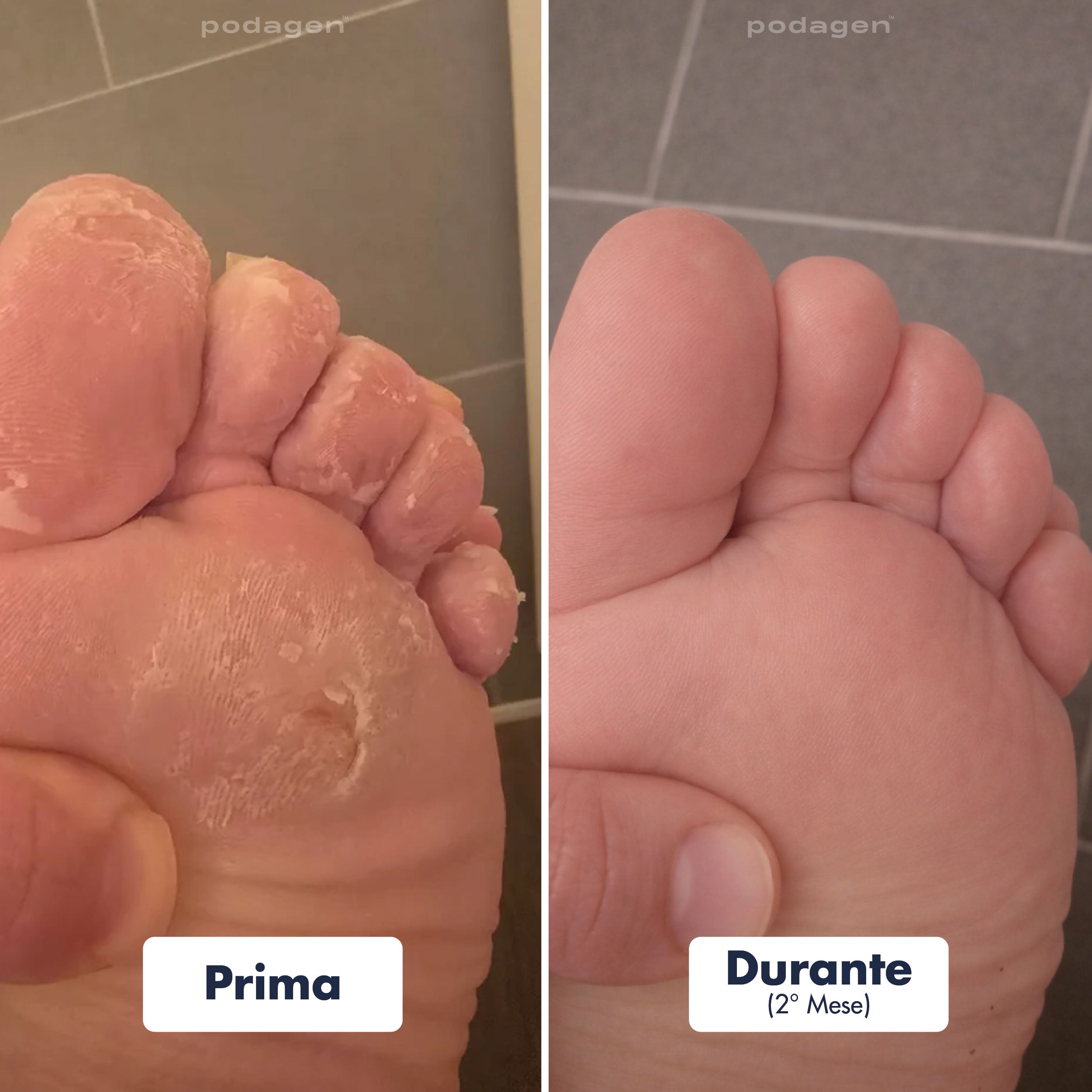 Penna Trattamento Piedi Uomo