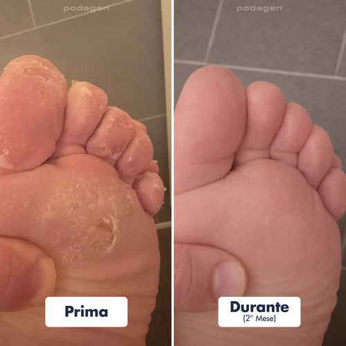Penna Trattamento Piedi Uomo