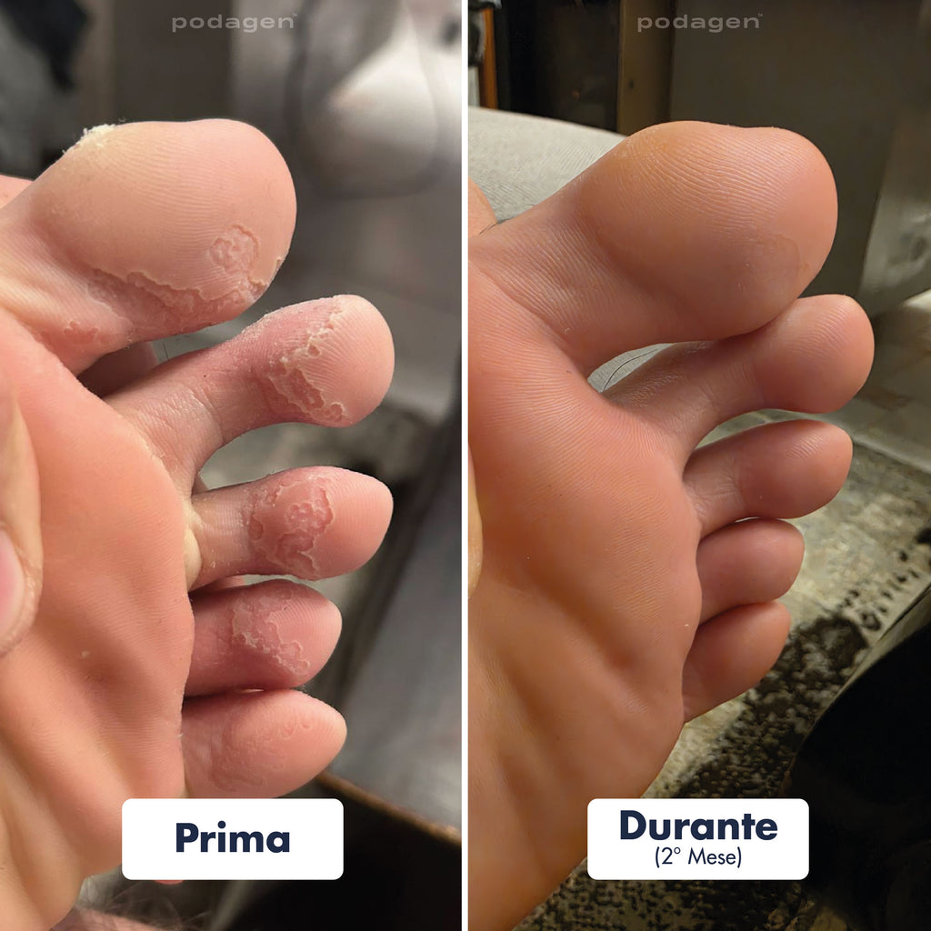 Penna Trattamento Piedi Uomo